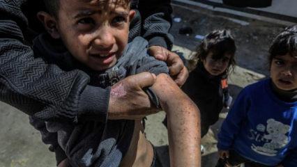 Gazze'de salgın uyarısı: Sağlık bakanlığından DS&Ouml;'ye &ccedil;ağrı