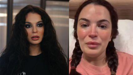 Doktor hatası y&uuml;z&uuml;nden 6 kez ameliyat oldu! Aslı Bekiroğlu son durumunu paylaştı