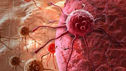 V&uuml;cudunuzun sessiz uyarıları: Kanser &ouml;ncesi belirtileri g&ouml;z ardı etmeyin!