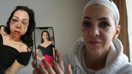 Y&uuml;z&uuml; par&ccedil;alanan annenin hukuk m&uuml;cadelesi: Hem darbedildi hem tehdit ediliyor