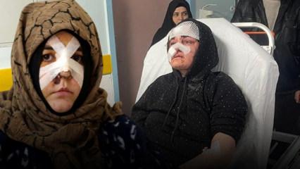 27 yaşındaki Nazlı dehşeti yaşadı! Kaldırım taşı 'silah' sayıldı