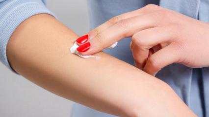 B&ouml;cek ısırığı kremi: Bu yaz kaşıntıya son