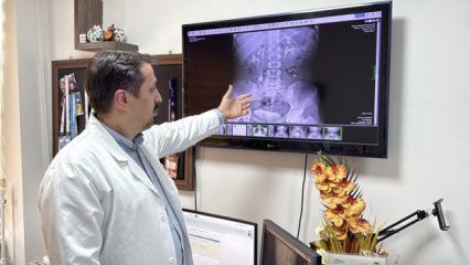 İdrar kanalından &ccedil;ıkan taşlar doktor, hasta ve yakınlarını şaşırttı