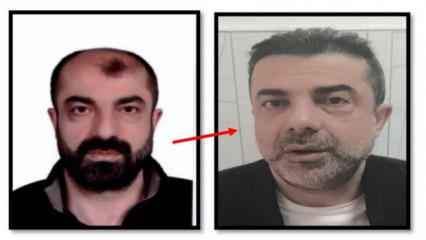 Y&uuml;z&uuml;n&uuml; değiştiren firari zanlı 7 yıl sonra yakalandı