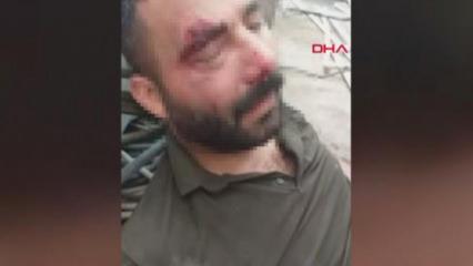 12 metre y&uuml;kseklikten beton zemine d&uuml;şen iş&ccedil;i: Ailemin tek ge&ccedil;im kaynağı benim