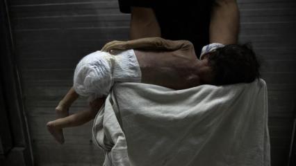 Gazze&rsquo;de sessiz felaket: Bebeklerde anomali ve &ouml;l&uuml;m oranları artıyor