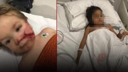 Ankara'da 2 kardeş pitbull saldırısına uğramıştı! Yeni gelişme 