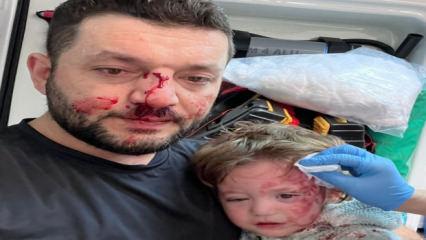 Kucağındaki bebeğiyle darbedilen babanın feryadı: Kızım &ccedil;ırpınırken tekrar vurdu
