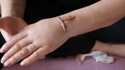 Diyarbakır'da kan donduran olay! Eşini 30 yerinden bı&ccedil;akladı 