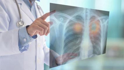 60 yıllık tiryakiliğin ağır faturası: Kanser ve Koah'a rağmen gelen "İkinci Bahar"