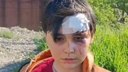 K&uuml;tahya'da başıboş k&ouml;pek dehşeti! 2 &ccedil;ocuk saldırıya uğradı
