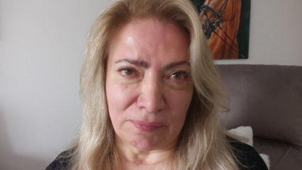 Ankara'da estetik kabusu: Y&uuml;z felci ge&ccedil;irdiğini iddia etti 