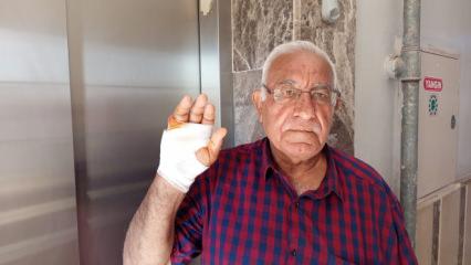 Hatay'da akılalmaz hadise: Komşusunun ısırdığı parmak koparıldı 