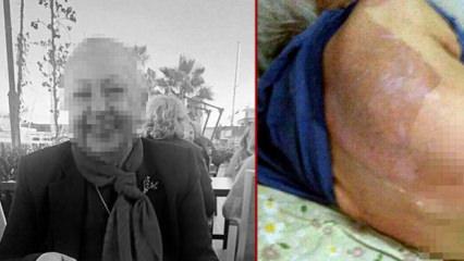 Huzurevinde banyo sonrası hastanelik olmuştu: &Ouml;l&uuml;m davasında doktora 6 taksitli ceza 