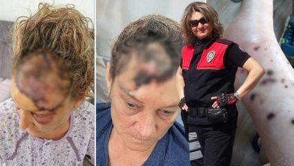 V&uuml;cuduna 80 dikiş atıldı: Patronunun k&ouml;peği tarafından par&ccedil;alanan koruma isyan etti