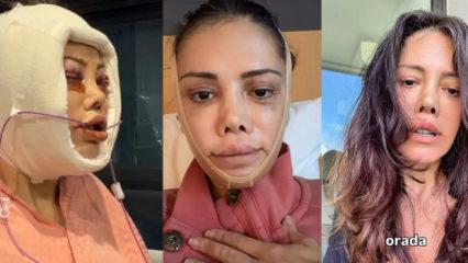 Kore'de y&uuml;z nakli ge&ccedil;irmişti! Gelen yorumla &ccedil;ileden &ccedil;ıkmıştı