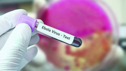 Fransa'da ebola vakası g&ouml;r&uuml;ld&uuml;