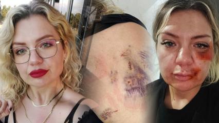 15 dakika boyunca bı&ccedil;aklanan &Ouml;zge: Bı&ccedil;ak kırılmasaydı zaten yaşama şansım yoktu