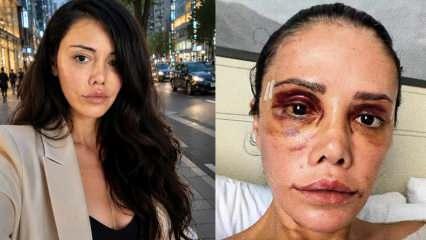 Y&uuml;z nakli sonrası tekrar ameliyat olmuştu! Didem Ceran CİMER'e şikayet etmişler diyerek duyurdu