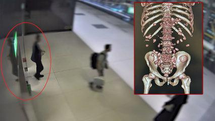 Y&uuml;r&uuml;mekte zorlanınca yakayı ele verdi! Midesinde tam 26 kaps&uuml;l uyuşturucu &ccedil;ıktı!