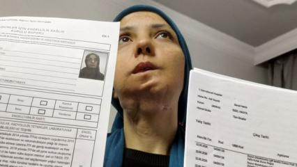 11 yılda 35 kez ameliyat oldu: 3 &ccedil;ocuk annesi kadının dili kesilebilir