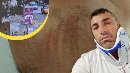 Samsun'da beyzbol sopalı pusu: Can g&uuml;venliği kalmayan aile şehri terk etti