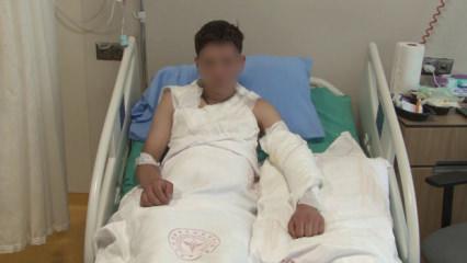 Merakı başına iş aştı! V&uuml;cudunun y&uuml;zde 25'i yandı... Kolonya şişesi bomba gibi patladı