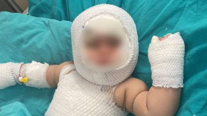 Mersin'de konserve faciası! 9 aylık bebek yandı 