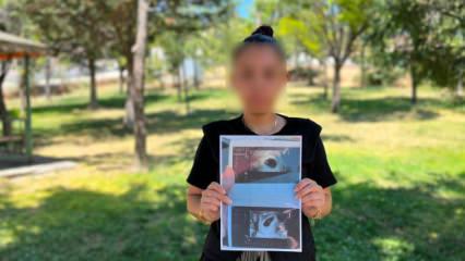 Vahim iddia: 7 haftalık hamile kadına "boş gebelik olabilir" raporu verildi