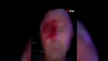 Haber yaparken saldırıya uğrayan muhabir yaralandı