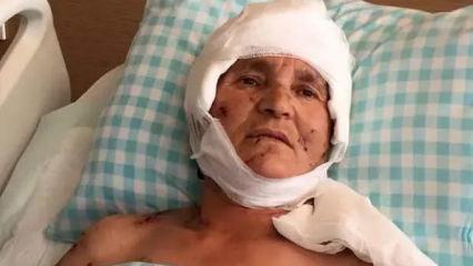 Kırşehir'de k&ouml;pek saldırısına uğrayan 63 yaşındaki kadına tazminat &ouml;denecek