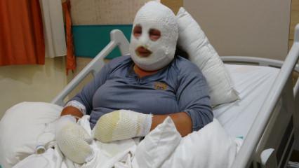 Ardahan'da evladı i&ccedil;in alevlerin arasına giren anne yandı 
