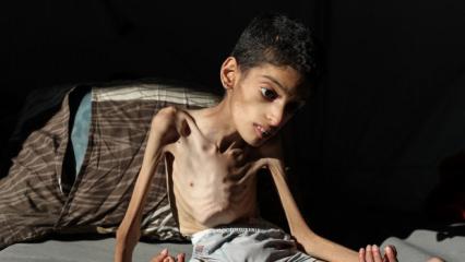 16 yaşındaki Gazzeli İbrahim 7,5 kiloya d&uuml;şt&uuml;