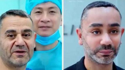 58 yaşında gen&ccedil;leşmek istedi, Vietnam'a gitti! T&uuml;rk uzmandan olay estetik yorumu