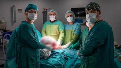 Karın ağrısıyla doktora gitti ger&ccedil;eği g&ouml;r&uuml;nce şaşkına d&ouml;nd&uuml;! Tam 15 kg &ccedil;ıkarıldı...