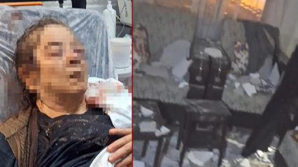 Kayseri'de inanması g&uuml;&ccedil; olay! Evinin salonunda otururken kan revan i&ccedil;inde kaldı