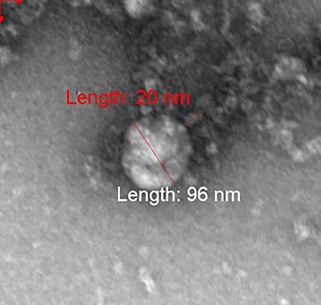 <p>Vektor Devlet Araştırma Merkezi’nden bilim insanları, İngiltere’de ortaya çıkan corona virüs mutasyonunun mikroskopla fotoğrafını çekti. </p>
