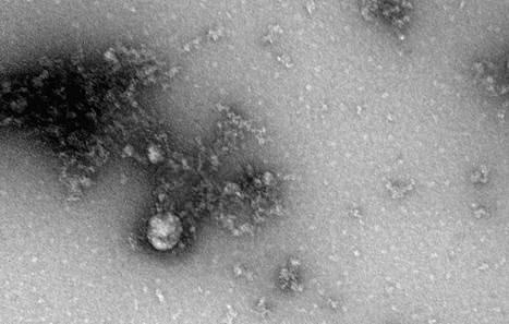 <p>BİRÇOK ÜLKEDE GÖRÜLDÜ</p>

<p>İlk olarak İngiltere’de Eylül ayında tespit edilen, Aralık ayına kadar da tanımlanamayan corona virüsün yeni mutasyonu şimdiye kadar Türkiye'nin de aralarında bulunduğu birçok ülkede görüldü. </p>
