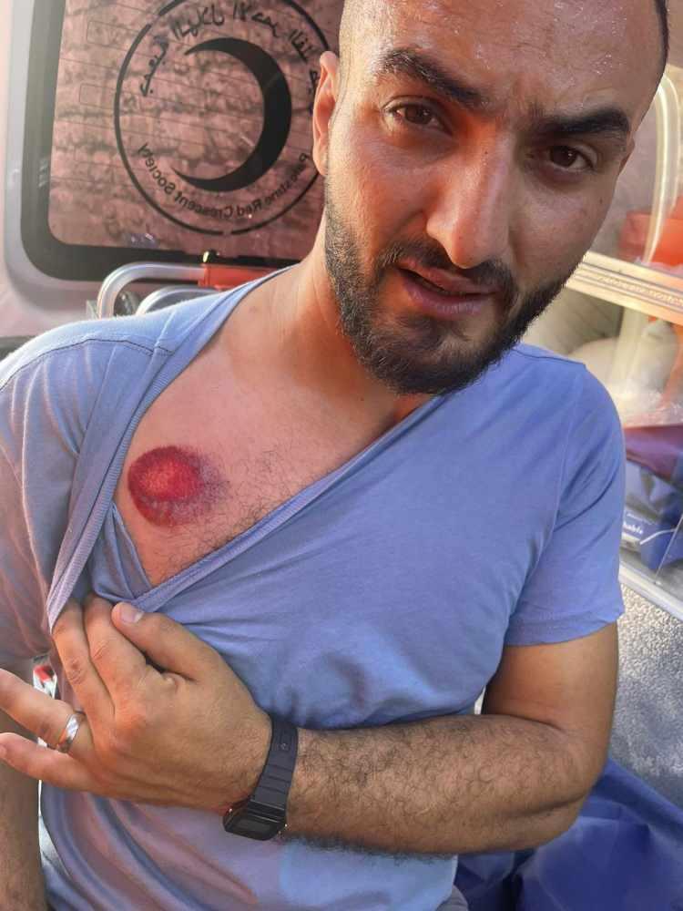<p>İsrail polisi Mesci-i Aksa'da AA  foto muhabiri Mostafa Alkharouf'u göğsünden plastik verme ile vurarak yaraladı. Mustafa iki gün önce de sırtından vurulmuştu.</p>
