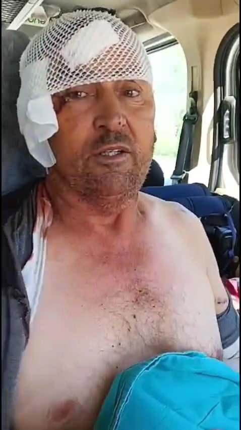 <p>Süleyman Kır'ın oğlu Ahmet Kır ise aslanın saldırısına uğrayan babasının videosunu yayımladı. Videoda Kır, <strong>"Üstümde battaniye vardı. Battaniyeyi kaldırdığımda aslanın üzerime çöktüğünü gördüm. Aslanla bir süre boğuştuk. Yardım istedik, çevrede kimse yoktu. Bu sırada aslan baldırımı ve boynumu ısırdı. Boynunu yakalayarak sıktım, o esnada kaçtı. Yaklaşık on metre uzaklaşıp dikildi. O sırada kolluk kuvvetleri geldi." </strong>ifadelerini kullandı.</p>