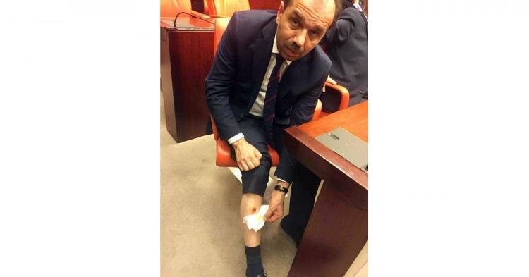 <p>Görüşmeler esnasında çıkan arbedede, AK Partili vekil Muhammet Balta bacağından ısırıldı.</p>
