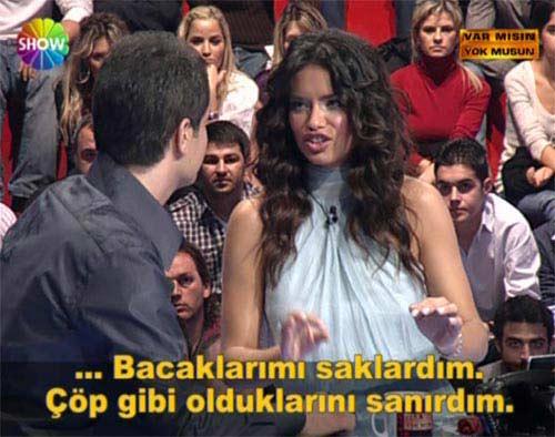 Gençken çok zayıf olduğunu söyleyen Adriana Lima, "Çekici ya da güzel olduğumu düşünmezdim. Bacaklarımı saklardım. Çöp gibi olduklarını sanırdım. Hep uzun etek giyerdim, çünkü bacaklarım çok inceydi" diye konuştu.
