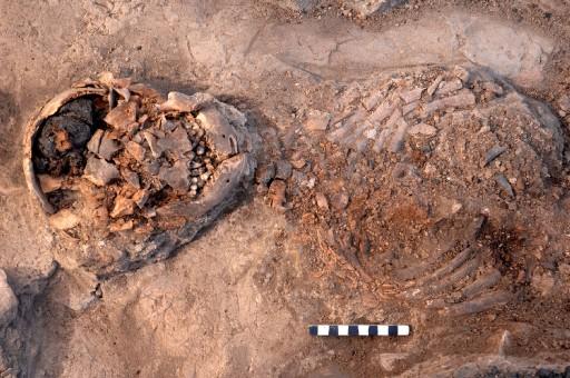 Kütahya'nın Seyitömer beldesi yakınlarındaki höyükte sürdürülen kurtarma kazısında bulunan 6 insan iskeletine ait kafa taslarının içinde şekli bozulmamış beyinler bulundu.