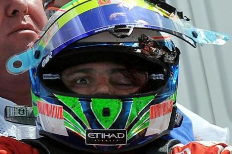 Formula 1'de sezonun 10. yarışı olan Macaristan Grand Prix'sinde Cumartesi günü yapılan sıralama turlarında, kaza yapan Ferrari'nin Brezilyalı pilotu Felipe Massa'nın, kafasındaki kaska yaklaşık 1 kilogram ağırlığındaki bir çelik yayın çarptığı açıklandı.