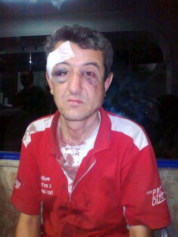 Antalya'da bir benzin istasyonunda tartıştığı pompacıyı evire çevire dövdü. Sivil polis memurunun pompacıyı darp anı benzin istasyonunun güvenlik kamaralarınca kaydedildi.