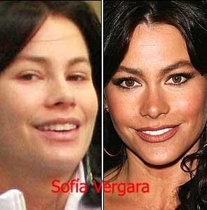 Sofis Vergara