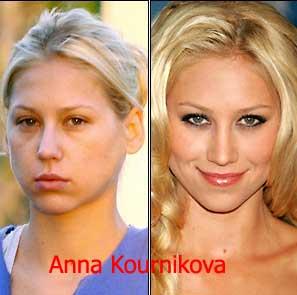 Anna Kournikova