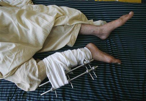 Pakistan ordusunun Taliban militanlarına yönelik saldırıları sürerken bölgeyi terk eden 500 bin kişiyi aşkın sivil zor şartlarda hayatta kalma mücadelesi veriyor.