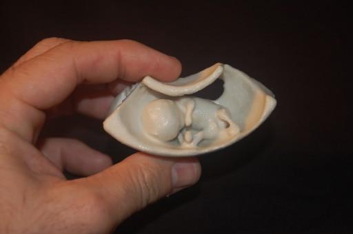 Yeni geliştirilen bir teknoloji ile fetüsün birebir ölçüde ve 3 boyutlu plastik modeli elde edilebiliyor.