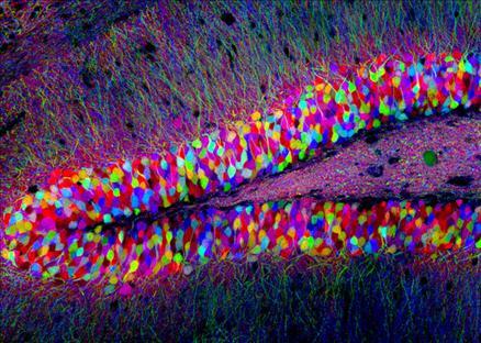 18. Dr. Tamily Weissman - Department of Molecular and Cellular Biology - Harvard University - Cambridge, Massachusetts, ABD Konu mankeni: Transgenik fare hipokampüsü Büyütme: 40x